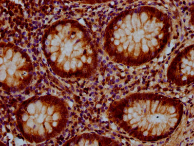 GLRX5 / Glutaredoxin 5 Antibody - Immunohistochemistry Dilution at 1:500 and staining in paraffin-embedded human appendix tissue performed on a Leica BondTM system. After dewaxing and hydration, antigen retrieval was mediated by high pressure in a citrate buffer (pH 6.0). Section was blocked with 10% normal Goat serum 30min at RT. Then primary antibody (1% BSA) was incubated at 4°C overnight. The primary is detected by a biotinylated Secondary antibody and visualized using an HRP conjugated SP system.