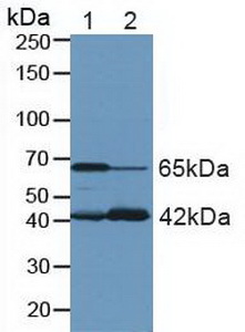 GLS / Glutaminase Antibody - Western Blot; Lane1: Rat Brain Tissue; Lane2: Rat Kidney Tissue.