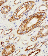 GLS / Glutaminase Antibody - Immunohistochemical of paraffin-embedded H.kidney section using GLS Antibody. Antibody was diluted at 1:25 dilution. A peroxidase-conjugated goat anti-rabbit IgG at 1:400 dilution was used as the secondary antibody, followed by DAB staining.