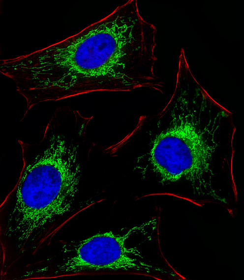GLS / Glutaminase Antibody - Fluorescent image of HeLa cells stained with XAF1 GLS Antibody. Antibody was diluted at 1:25 dilution. An Alexa Fluor 488-conjugated goat anti-rabbit lgG at 1:400 dilution was used as the secondary antibody (green). DAPI was used to stain the cell nuclear (blue). Cytoplasmic actin was counterstained with Alexa Fluor 555 conjugated with Phalloidin (red).