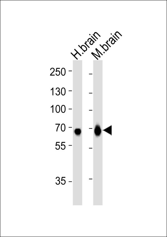 GLS / Glutaminase Antibody - Western blot of lysates from human brain and mouse brain tissue lysate (from left to right), using GLS Antibody. Antibody was diluted at 1:1000 at each lane. A goat anti-rabbit IgG H&L (HRP) at 1:5000 dilution was used as the secondary antibody. Lysates at 35ug per lane.
