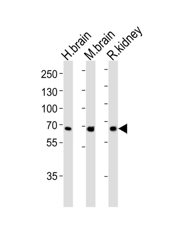GLS / Glutaminase Antibody - Western blot of lysates from human brain, mouse brain ad rat kidney tissue lysate (from left to right), using GLS Antibody. Antibody was diluted at 1:1000 at each lane. A goat anti-rabbit IgG H&L (HRP) at 1:5000 dilution was used as the secondary antibody. Lysates at 35ug per lane.