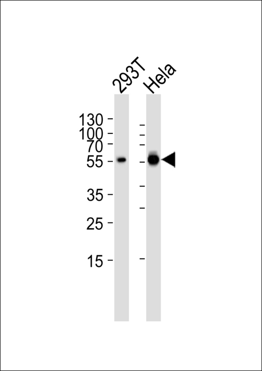 GLS / Glutaminase Antibody - Western blot of lysates from 293T, HeLa cell line (from left to right), using GLS Antibody. Antibody was diluted at 1:1000 at each lane. A goat anti-rabbit IgG H&L (HRP) at 1:5000 dilution was used as the secondary antibody. Lysates at 35ug per lane.