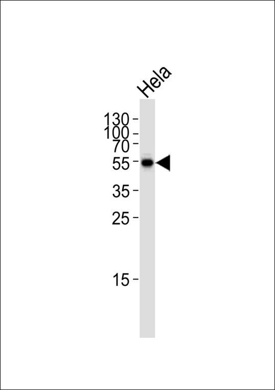 GLS / Glutaminase Antibody - Western blot of lysate from HeLa cell line, using GLS Antibody. Antibody was diluted at 1:1000. A goat anti-rabbit IgG H&L (HRP) at 1:5000 dilution was used as the secondary antibody. Lysate at 35ug.