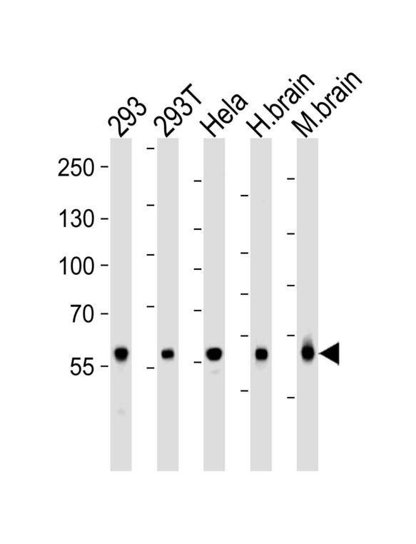 GLS / Glutaminase Antibody - Western blot of lysates from 293, 293T, HeLa cell line , human brain and mouse brain tissue lysate (from left to right), using GLS Antibody. Antibody was diluted at 1:1000 at each lane. A goat anti-rabbit IgG H&L (HRP) at 1:5000 dilution was used as the secondary antibody. Lysates at 35ug per lane.