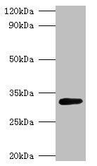 GLS / Glutaminase Antibody - Western blot All lanes: glsA1 antibody at 2µg/ml + DH5a whole cell lysate Secondary Goat polyclonal to rabbit IgG at 1/10000 dilution Predicted band size: 33 kDa Observed band size: 33 kDa