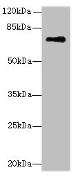 GLS / Glutaminase Antibody - Western blot All lanes: GLS antibody at 5µg/ml + Mouse brain tissue Secondary Goat polyclonal to rabbit IgG at 1/10000 dilution Predicted band size: 74, 18, 66 kDa Observed band size: 74 kDa