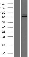 GLS / Glutaminase Protein - Western validation with an anti-DDK antibody * L: Control HEK293 lysate R: Over-expression lysate