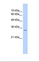 GLS2 / Glutaminase 2 Antibody - HepG2 cell lysate. Antibody concentration: 2.5 ug/ml. Gel concentration: 12%.  This image was taken for the unconjugated form of this product. Other forms have not been tested.