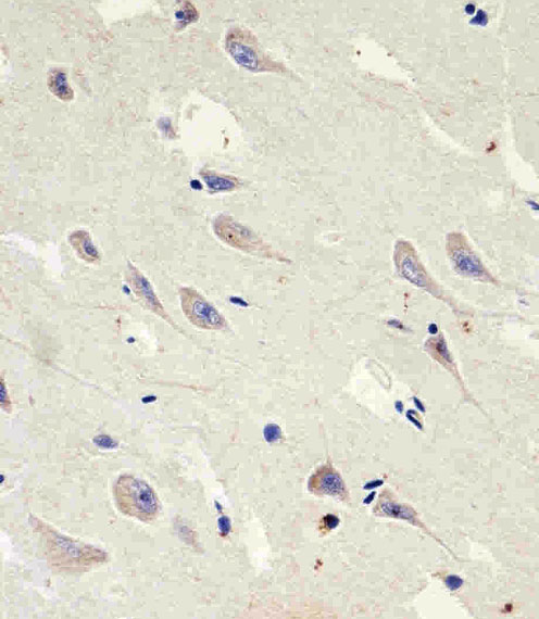 GLS2 / Glutaminase 2 Antibody - Immunohistochemical of paraffin-embedded H.brain section using GLS2 Antibody (C-term E513). Antibody was diluted at 1:25 dilution. A peroxidase-conjugated goat anti-rabbit IgG at 1:400 dilution was used as the secondary antibody, followed by DAB staining.
