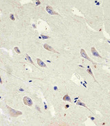 GLS2 / Glutaminase 2 Antibody - Immunohistochemical of paraffin-embedded H.brain section using GLS2 Antibody (C-term E513). Antibody was diluted at 1:25 dilution. A peroxidase-conjugated goat anti-rabbit IgG at 1:400 dilution was used as the secondary antibody, followed by DAB staining.