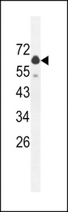GLS2 / Glutaminase 2 Antibody - GLS2 Antibody (C-term E513) western blot of mouse brain tissue lysates (35 ug/lane). The GLS2 antibody detected the GLS2 protein (arrow).