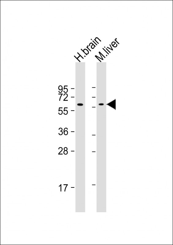 GLS2 / Glutaminase 2 Antibody - All lanes: Anti-GLS2 Antibody at 1:1000-1:2000 dilution Lane 1: human brain lysate Lane 2: mouse liver lysate Lysates/proteins at 20 µg per lane. Secondary Goat Anti-mouse IgG, (H+L), Peroxidase conjugated at 1/10000 dilution. Predicted band size: 66 kDa Blocking/Dilution buffer: 5% NFDM/TBST.