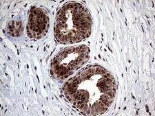 GLS2 / Glutaminase 2 Antibody - Immunohistochemical staining of paraffin-embedded Human breast tissue within the normal limits using anti-GLS2 mouse monoclonal antibody. (Heat-induced epitope retrieval by 1mM EDTA in 10mM Tris buffer. (pH8.5) at 120°C for 3 min. (1:2000)