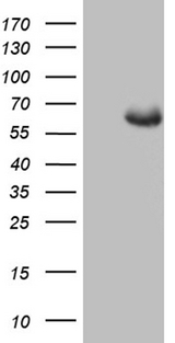 GLS2 / Glutaminase 2 Antibody - HEK293T cells were transfected with the pCMV6-ENTRY control. (Left lane) or pCMV6-ENTRY GLS2. (Right lane) cDNA for 48 hrs and lysed