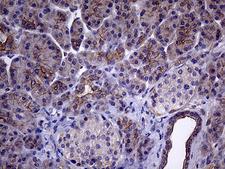 GLS2 / Glutaminase 2 Antibody - Immunohistochemical staining of paraffin-embedded Human pancreas tissue within the normal limits using anti-GLS2 mouse monoclonal antibody. (Heat-induced epitope retrieval by 1mM EDTA in 10mM Tris buffer. (pH8.5) at 120°C for 3 min. (1:2000)