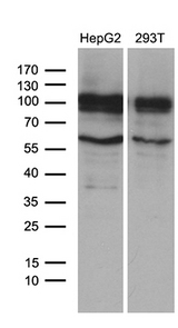 GLS2 / Glutaminase 2 Antibody - Western blot analysis of extracts. (35ug) from 2 different cell lines by using anti-GLS2 monoclonal antibody. (1:500)