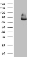 GLS2 / Glutaminase 2 Antibody - HEK293T cells were transfected with the pCMV6-ENTRY control. (Left lane) or pCMV6-ENTRY GLS2. (Right lane) cDNA for 48 hrs and lysed. Equivalent amounts of cell lysates. (5 ug per lane) were separated by SDS-PAGE and immunoblotted with anti-GLS2. (1:2000)