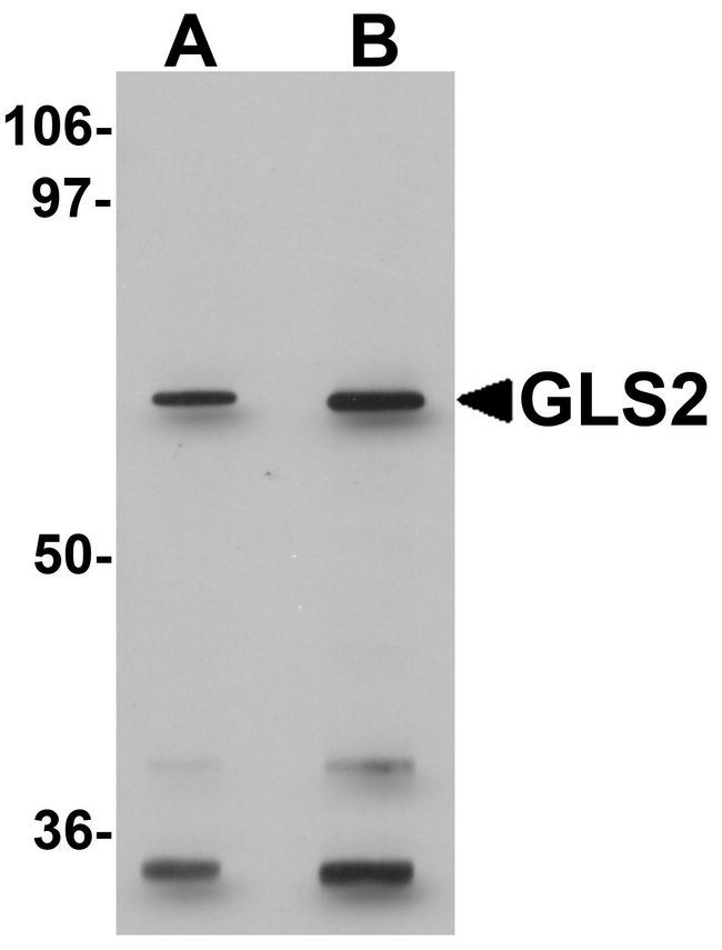 GLS2 / Glutaminase 2 Antibody - Western blot analysis of GLS2 in rat kidney tissue lysate with GLS2 antibody at (A) 0.5 and (B) 1 ug/ml.