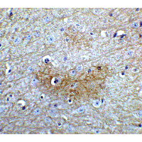 GLS2 / Glutaminase 2 Antibody - Immunohistochemistry of GLS2 in mouse brain tissue with GLS2 Antibodyat 5 µg/mL.