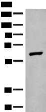 GLS2 / Glutaminase 2 Antibody - Western blot analysis of Mouse liver tissue lysate  using GLS2 Polyclonal Antibody at dilution of 1:400