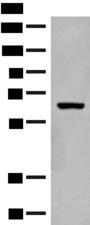 GLS2 / Glutaminase 2 Antibody - Western blot analysis of Mouse liver tissue lysate  using GLS2 Polyclonal Antibody at dilution of 1:400