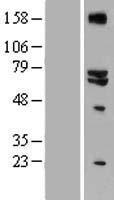 GLS2 / Glutaminase 2 Protein - Western validation with an anti-DDK antibody * L: Control HEK293 lysate R: Over-expression lysate