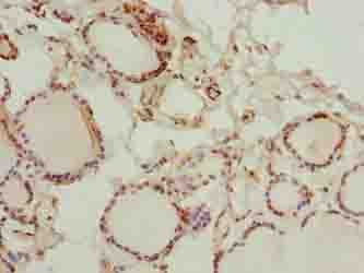 GLT1D1 Antibody - Immunohistochemistry of paraffin-embedded human thyroid tissue using antibody at dilution of 1:100.