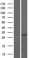 GLT1D1 Protein - Western validation with an anti-DDK antibody * L: Control HEK293 lysate R: Over-expression lysate