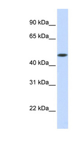 GLT8D1 Antibody - GLT8D1 antibody Western blot of Fetal Muscle lysate. This image was taken for the unconjugated form of this product. Other forms have not been tested.