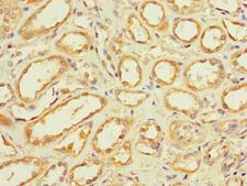 GLT8D1 Antibody - Immunohistochemistry of paraffin-embedded human kidney tissue using GLT8D1 Antibody at dilution of 1:100