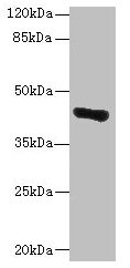 GLT8D1 Antibody - Western blot All lanes: GLT8D1 antibody at 10µg/ml + Mouse liver tissue Secondary Goat polyclonal to rabbit IgG at 1/10000 dilution Predicted band size: 42, 29 kDa Observed band size: 42 kDa