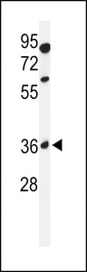 GLT8D2 Antibody - Western blot of GL8D2 Antibody in 293 cell line lysates (35 ug/lane). GL8D2 (arrow) was detected using the purified antibody.