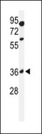 GLT8D2 Antibody - Western blot of GL8D2 Antibody in 293 cell line lysates (35 ug/lane). GL8D2 (arrow) was detected using the purified antibody.