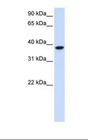 GLT8D2 Antibody - Fetal muscle lysate. Antibody concentration: 1.0 ug/ml. Gel concentration: 12%.  This image was taken for the unconjugated form of this product. Other forms have not been tested.