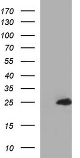GLTP Antibody - HEK293T cells were transfected with the pCMV6-ENTRY control (Left lane) or pCMV6-ENTRY GLTP (Right lane) cDNA for 48 hrs and lysed. Equivalent amounts of cell lysates (5 ug per lane) were separated by SDS-PAGE and immunoblotted with anti-GLTP.