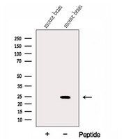 GLTP Antibody - Western blot analysis of extracts of mouse brain tissue using GLTP antibody. The lane on the left was treated with blocking peptide.