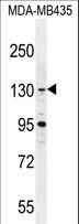 GLTSCR1 Antibody - GLTSCR1 Antibody western blot of MDA-MB435 cell line lysates (35 ug/lane). The GLTSCR1 antibody detected the GLTSCR1 protein (arrow).
