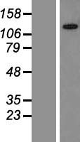 GLTSCR1L / KIAA0240 Protein - Western validation with an anti-DDK antibody * L: Control HEK293 lysate R: Over-expression lysate