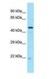 GLTSCR2 Antibody - GLTSCR2 antibody Western Blot of 293T cell lysate. GLTSCR2 is supported by BioGPS gene expression data to be expressed in HEK293T.  This image was taken for the unconjugated form of this product. Other forms have not been tested.