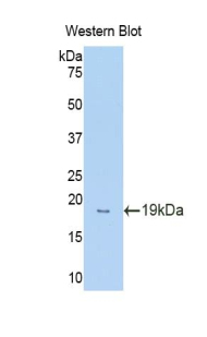 Glucocorticoid Receptor Alpha Antibody - Western blot of recombinant NR3C1/Glucocorticoid Receptor.  This image was taken for the unconjugated form of this product. Other forms have not been tested.