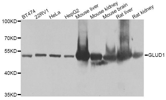 GLUD1/Glutamate Dehydrogenase Antibody - Western blot analysis of extracts of various cell lines.