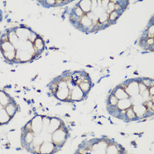 GLUD1/Glutamate Dehydrogenase Antibody - Immunohistochemistry of paraffin-embedded human colon tissue.