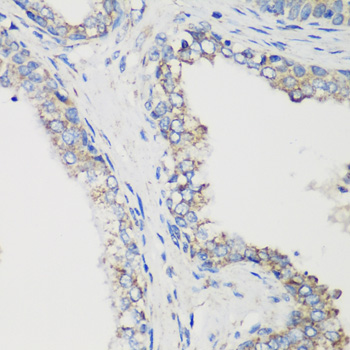 GLUD1/Glutamate Dehydrogenase Antibody - Immunohistochemistry of paraffin-embedded human prostate.