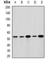 GLUD1/Glutamate Dehydrogenase Antibody - Western blot analysis of GLUD1 expression in HeLa (A); HepG2 (B); mouse liver (C); mouse brain (D); rat kidney (E) whole cell lysates.