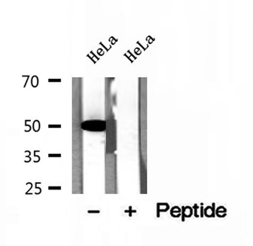 GLUD1/Glutamate Dehydrogenase Antibody - Western blot analysis of extracts of HeLa cells using GLUD1 antibody.