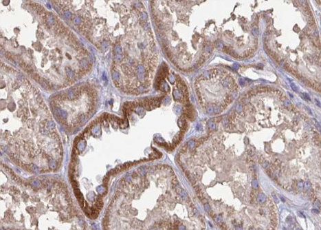 GLUD1/Glutamate Dehydrogenase Antibody - 1:100 staining mouse kidney tissue by IHC-P. The sample was formaldehyde fixed and a heat mediated antigen retrieval step in citrate buffer was performed. The sample was then blocked and incubated with the antibody for 1.5 hours at 22°C. An HRP conjugated goat anti-rabbit antibody was used as the secondary.