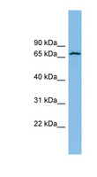 GLUD2 Antibody - GLUD2 antibody Western blot of RPMI-8226 cell lysate. This image was taken for the unconjugated form of this product. Other forms have not been tested.
