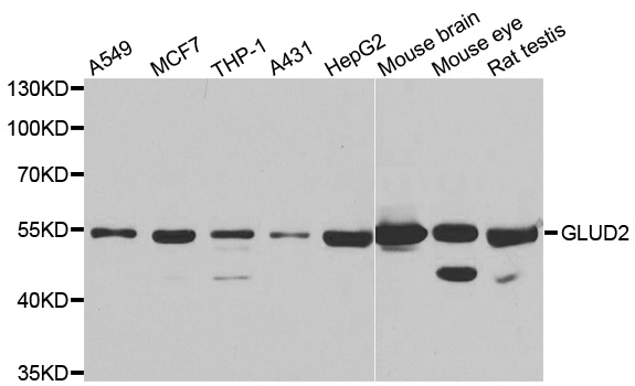 GLUD2 Antibody - Western blot analysis of extracts of various cell lines.
