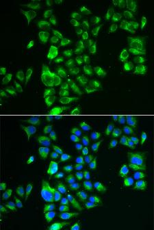 GLUD2 Antibody - Immunofluorescence analysis of A549 cells.